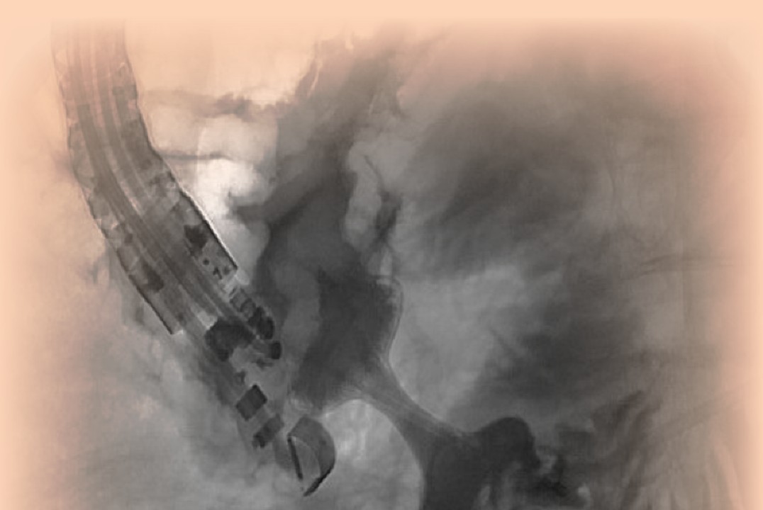 20.-21.11.2026 - HPB Advanced Course - Titelbild